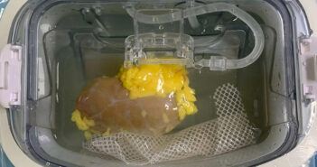 1510-fígado-layout_site © Faculdade de Medicina da Colúmbia Britânica/Nature Biomedical Engineering./Divulgação