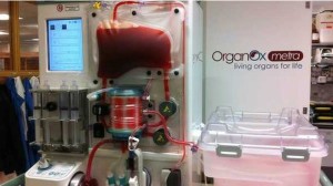 Esta máquina mantém o fígado vivo à temperatura normal do corpo (Foto: BBC)