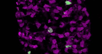 Células embrionárias (roxas) são afetadas por genes SOX17 (verdes), num processo até então desconhecido pela ciência - Walfred Tang, University of Cambridge / Universidade de Cambridge)