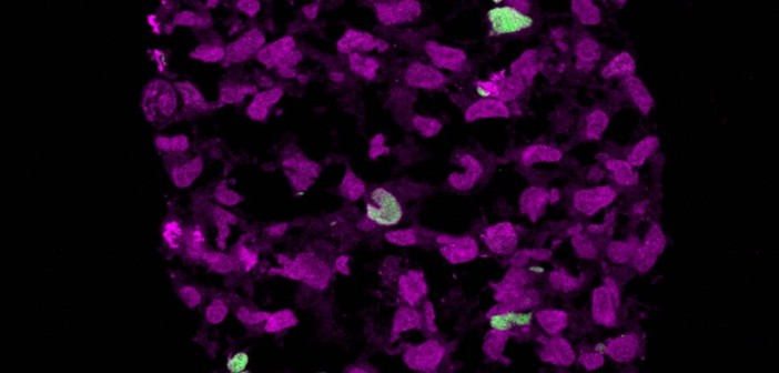 Células embrionárias (roxas) são afetadas por genes SOX17 (verdes), num processo até então desconhecido pela ciência - Walfred Tang, University of Cambridge / Universidade de Cambridge)