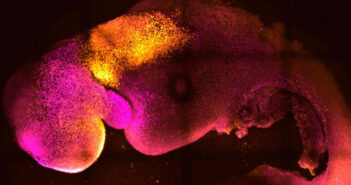Imagem microscópica de um embrião sintético de camundongo criado em laboratório; quase um ano depois, cientistas replicam experimento usando células-tronco humanas © Gianluca Amadei, Charlotte Handford/AP Photo/picture alliance