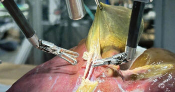 Ji Woong Kim / SRT-H (Hierarchical Surgical Robot Transformer)