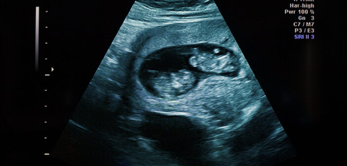 cromossomos XY, DNA XX